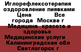 Иглорефлексотерапия, оздоровление пиявками › Цена ­ 3 000 - Все города, Москва г. Медицина, красота и здоровье » Медицинские услуги   . Калининградская обл.,Светлогорск г.